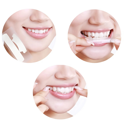 Smilumin – Zahnpflegeset mit LED-Lampe und Streifen